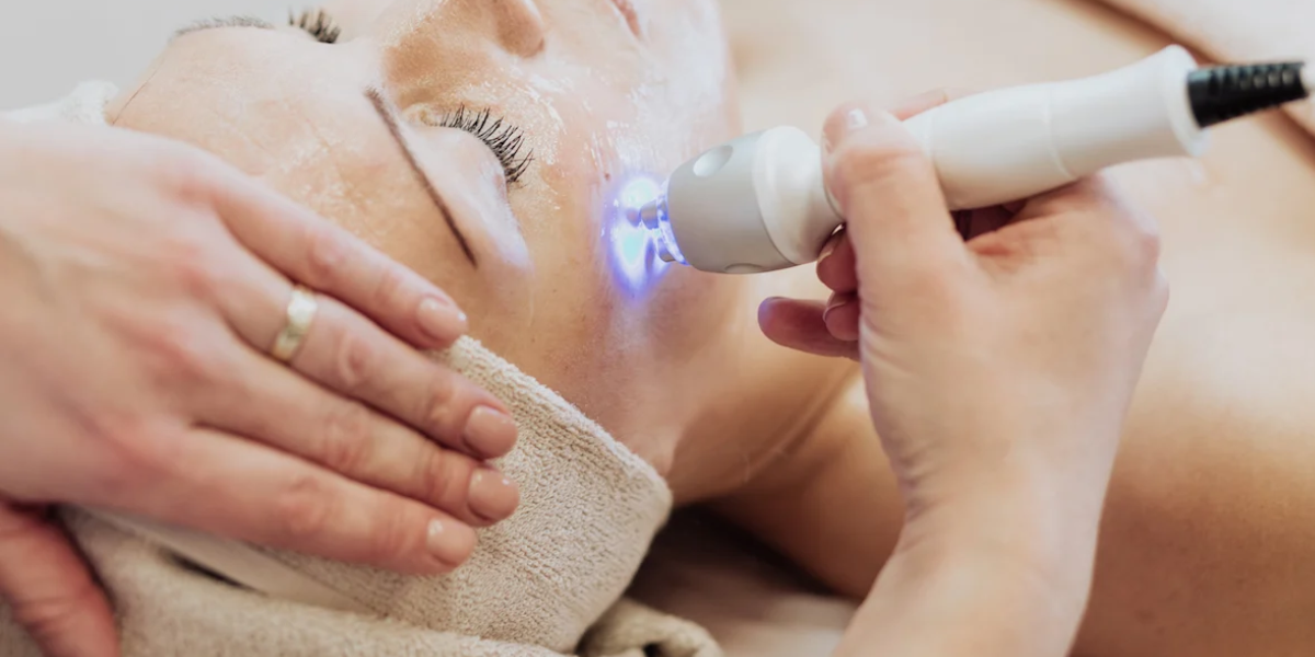 How Laser Treatments Can Effectively Reduce and Remove Acne Scars