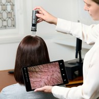 Doctor performing digital trichoscopy examination on a patient's scalp using a handheld diagnostic device and tablet display.