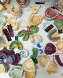 Dental impressions and restorative models used for biomimetic dentistry treatment planning and tooth preservation
